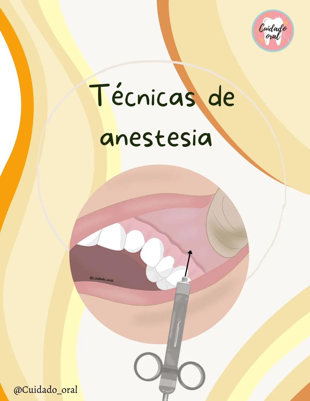 # Técnicas de
anestesia
@Cuidado_oral
@Cuidado.oral # Indice
Pagina 51 (BNAI)
Pagina 64-65 (Gol-gates)
Anestésicos locales
3-12
Considerac