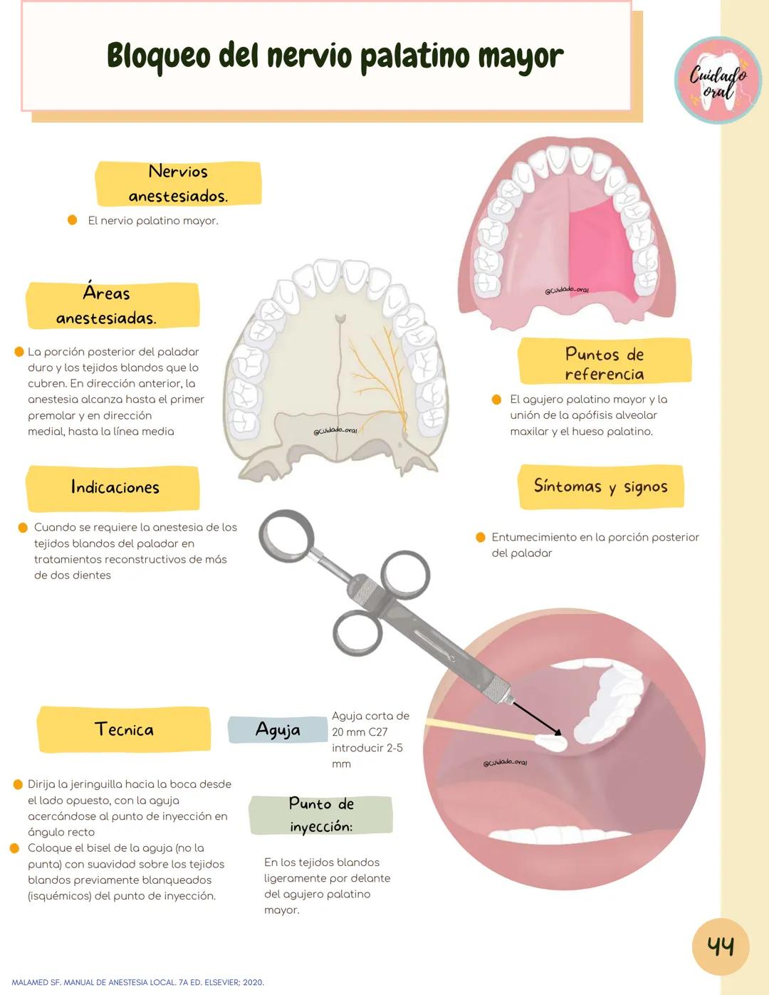 # Técnicas de
anestesia
@Cuidado_oral
@Cuidado.oral # Indice
Pagina 51 (BNAI)
Pagina 64-65 (Gol-gates)
Anestésicos locales
3-12
Considerac