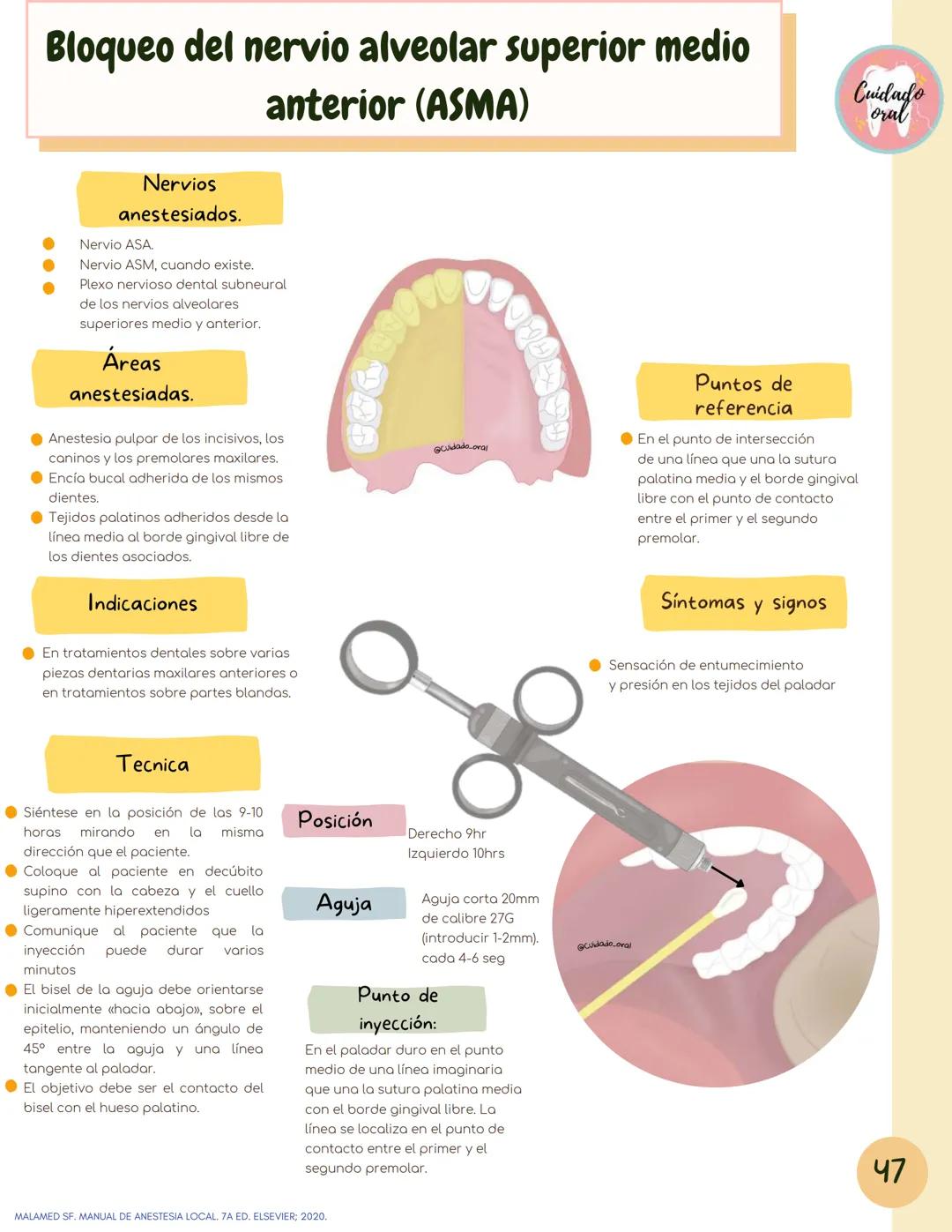 # Técnicas de
anestesia
@Cuidado_oral
@Cuidado.oral # Indice
Pagina 51 (BNAI)
Pagina 64-65 (Gol-gates)
Anestésicos locales
3-12
Considerac