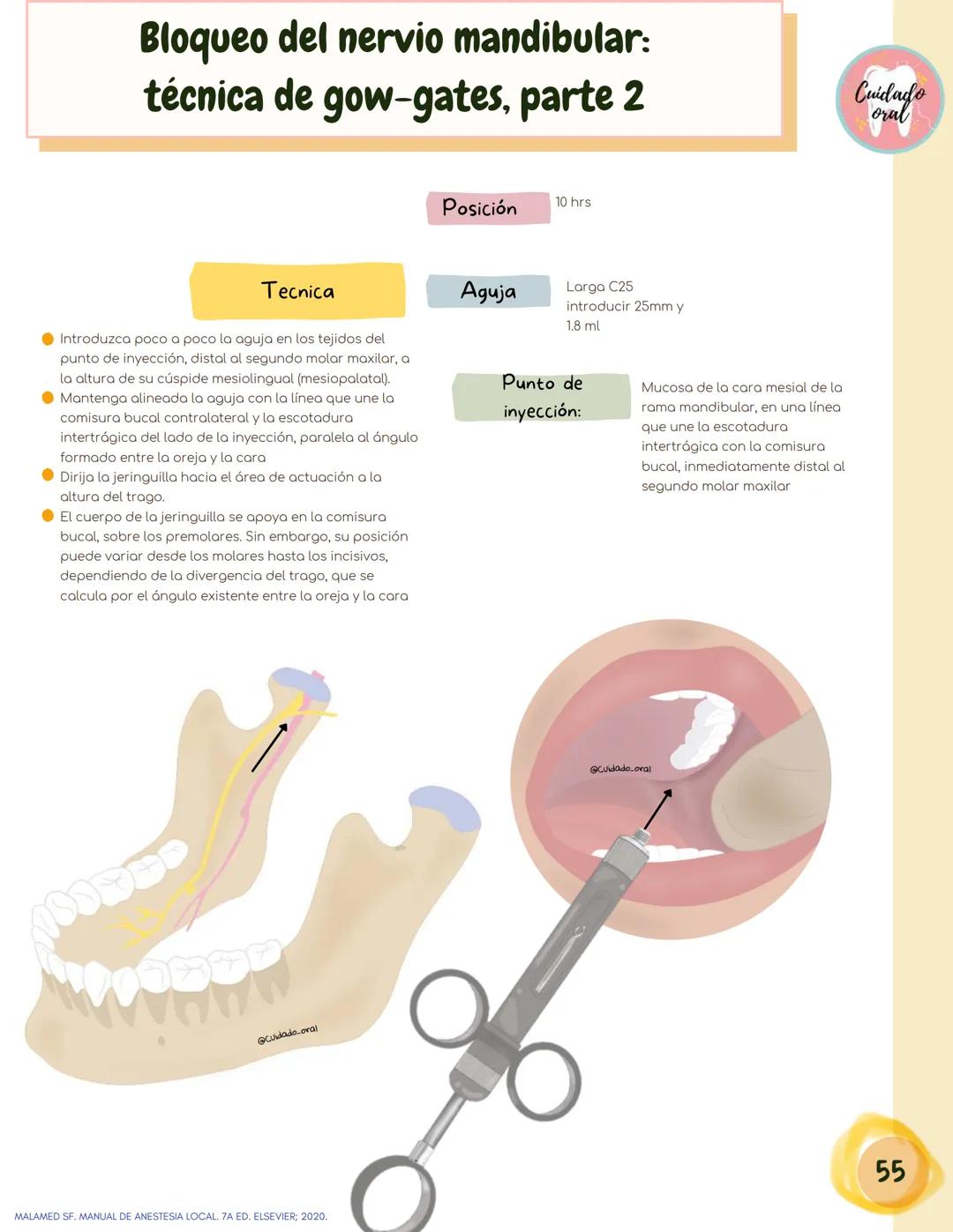 # Técnicas de
anestesia
@Cuidado_oral
@Cuidado.oral # Indice
Pagina 51 (BNAI)
Pagina 64-65 (Gol-gates)
Anestésicos locales
3-12
Considerac