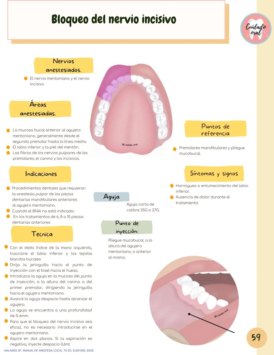 # Técnicas de
anestesia
@Cuidado_oral
@Cuidado.oral # Indice
Pagina 51 (BNAI)
Pagina 64-65 (Gol-gates)
Anestésicos locales
3-12
Considerac