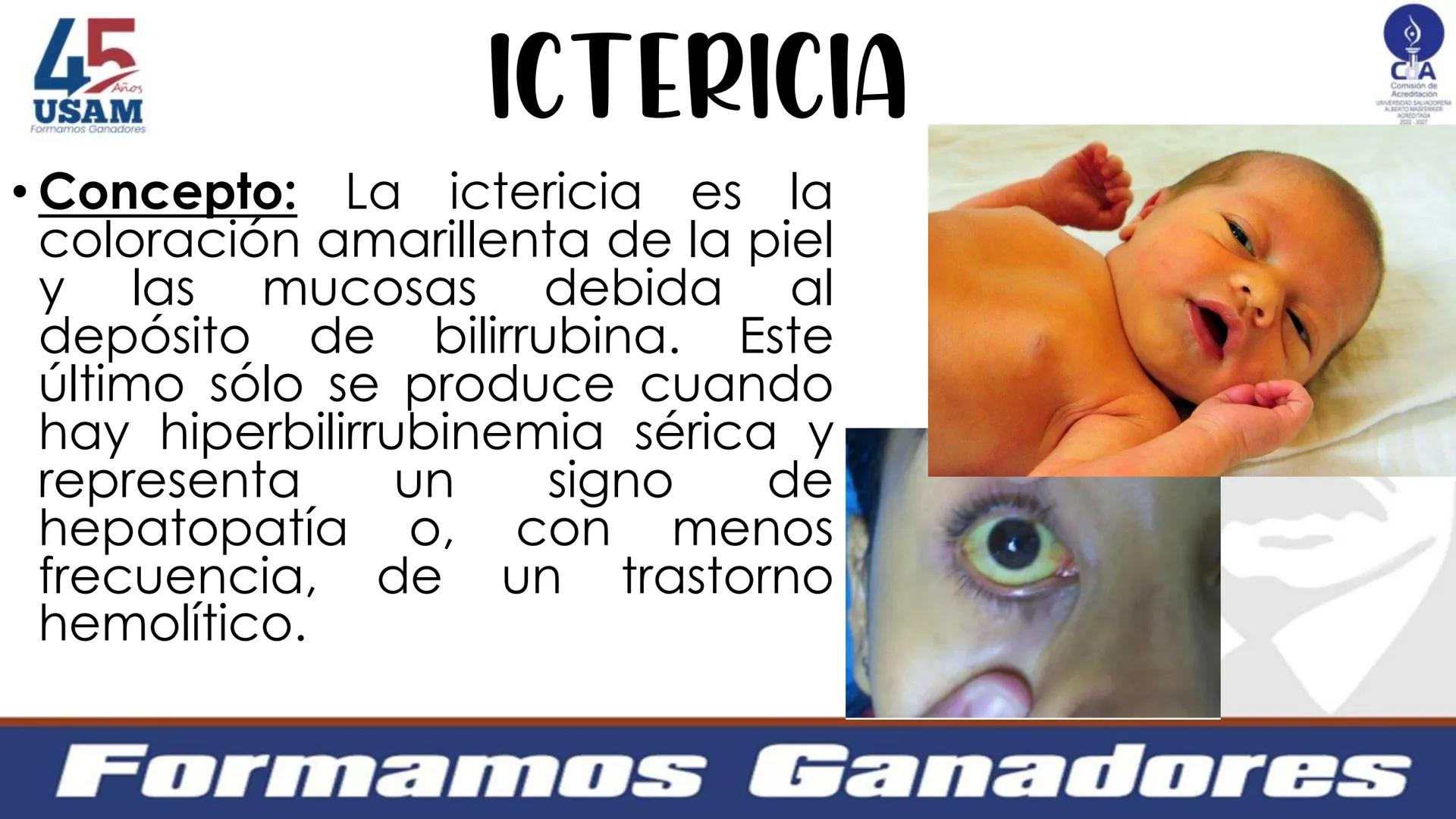 # Metabolismo de la bilirrubina
Dra. Vanessa Iglesias De vez en cuando,
obsérvate con objetividad.
Ni todo lo que piensas es
cierto, ni tod