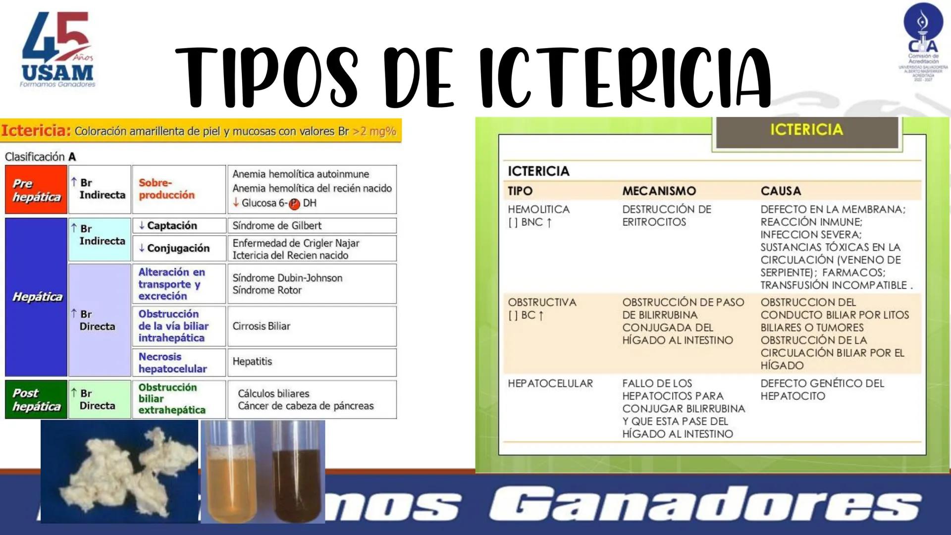 # Metabolismo de la bilirrubina
Dra. Vanessa Iglesias De vez en cuando,
obsérvate con objetividad.
Ni todo lo que piensas es
cierto, ni tod