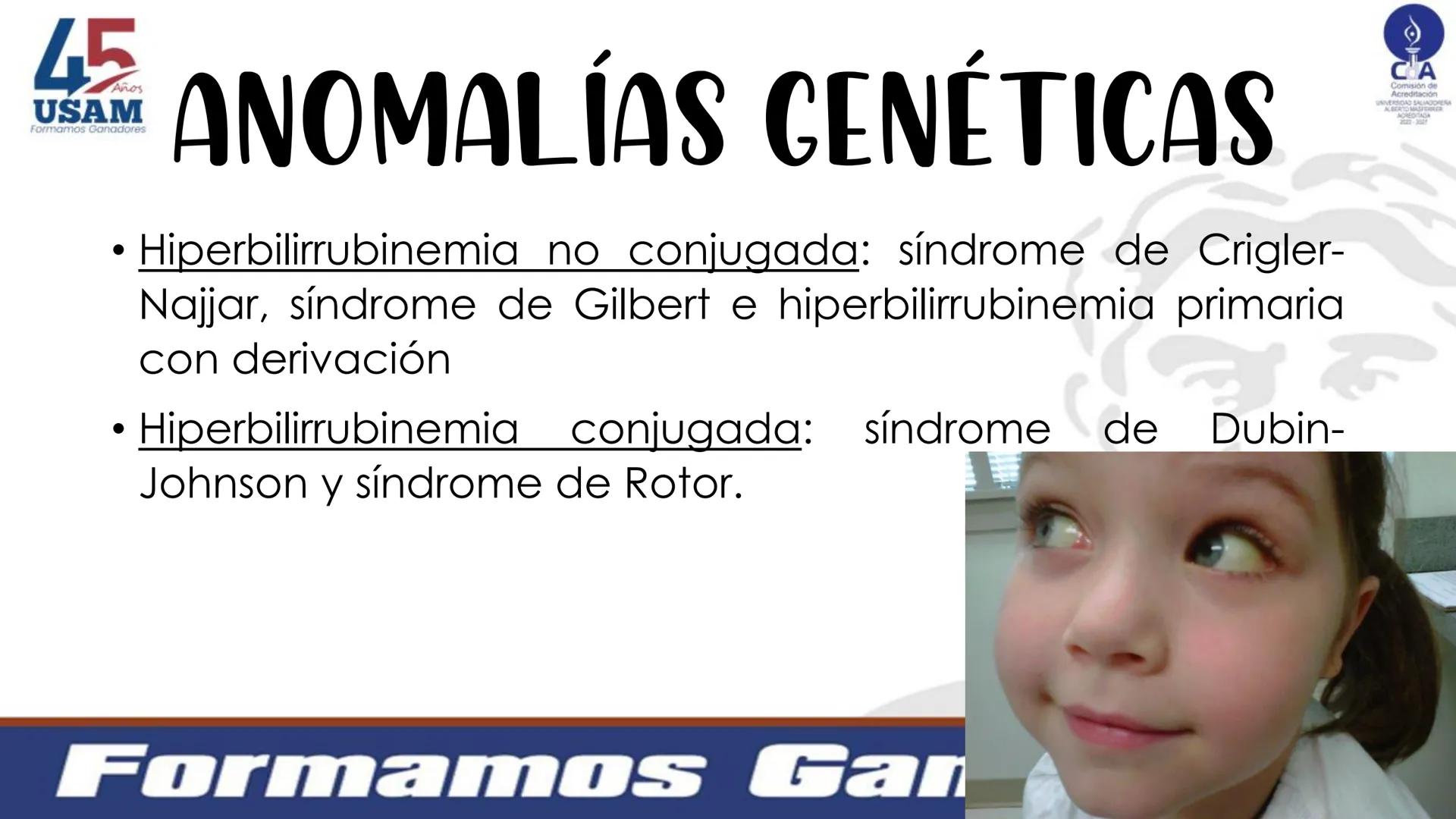# Metabolismo de la bilirrubina
Dra. Vanessa Iglesias De vez en cuando,
obsérvate con objetividad.
Ni todo lo que piensas es
cierto, ni tod