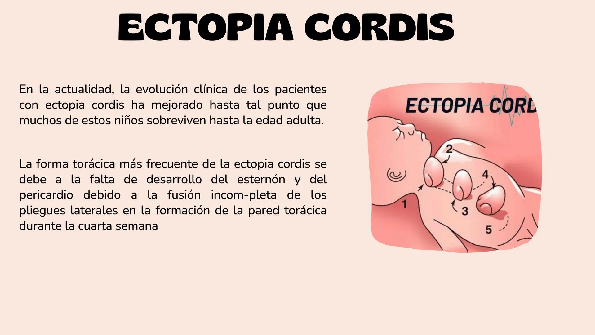 # Aparato cardiovascular
EN EL DESARROLLO EMBRIONARIO
UNIVERSIDAD
POLITÉCNICA
DE QUINTANA ROO
Formando Triunfadores.
Seno venoso
Arcos
