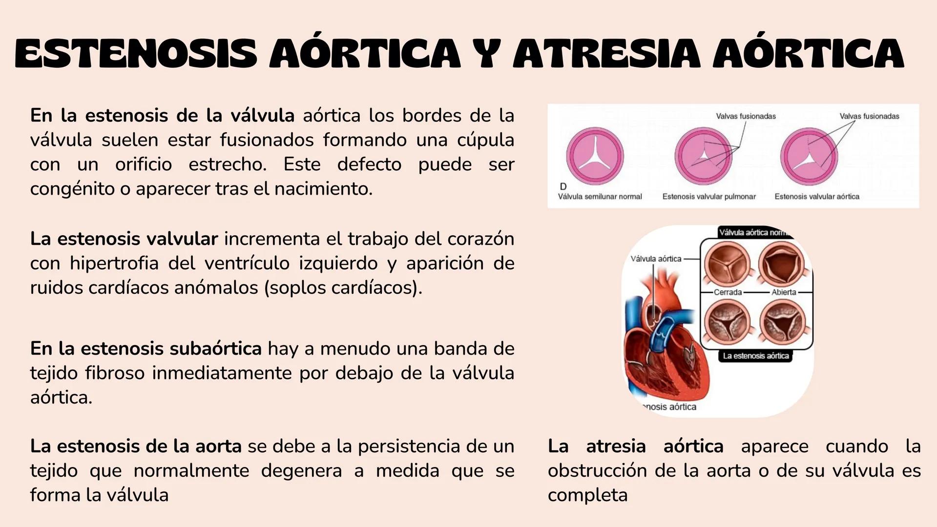 # Aparato cardiovascular
EN EL DESARROLLO EMBRIONARIO
UNIVERSIDAD
POLITÉCNICA
DE QUINTANA ROO
Formando Triunfadores.
Seno venoso
Arcos