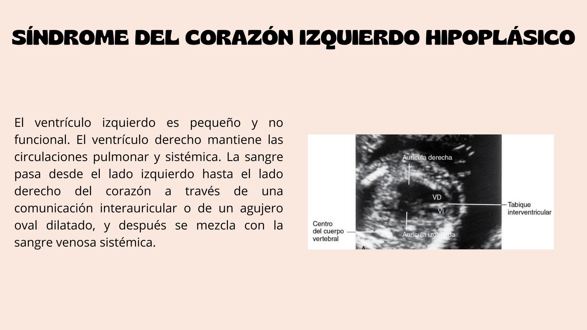 # Aparato cardiovascular
EN EL DESARROLLO EMBRIONARIO
UNIVERSIDAD
POLITÉCNICA
DE QUINTANA ROO
Formando Triunfadores.
Seno venoso
Arcos