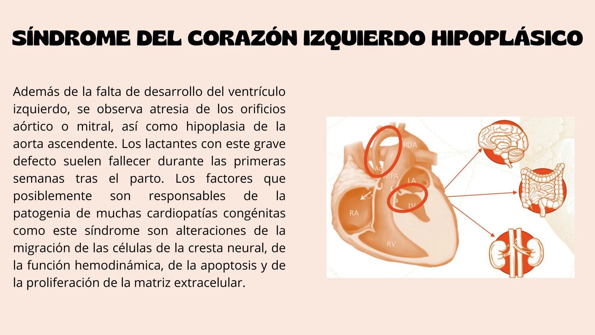 # Aparato cardiovascular
EN EL DESARROLLO EMBRIONARIO
UNIVERSIDAD
POLITÉCNICA
DE QUINTANA ROO
Formando Triunfadores.
Seno venoso
Arcos