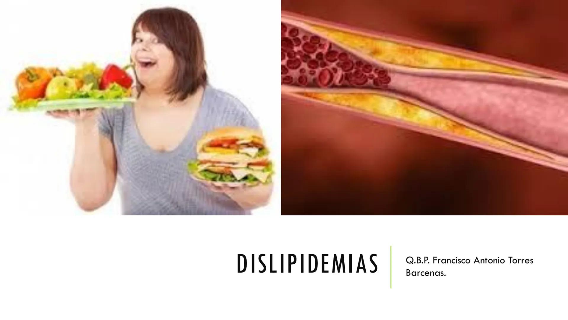 # DISLIPIDEMIAS
Q.B.P. Francisco Antonio Torres Barcenas. # DISLIPIDEMIAS.
Las dislipidemias o dislipemias son una serie de diversas condi