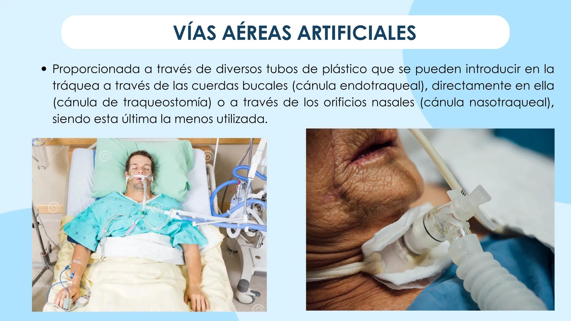 ♡
COMMUNITATIS MINISTERIUA
PMS
UNIVERSIDAD POLITECNICA
NERVA
UNIVERSIDAD POLITÉCNICA MINERVA
FUNDAMENTOS DE ENFERMERÍA I
OXIGENOTERAPIA,
D