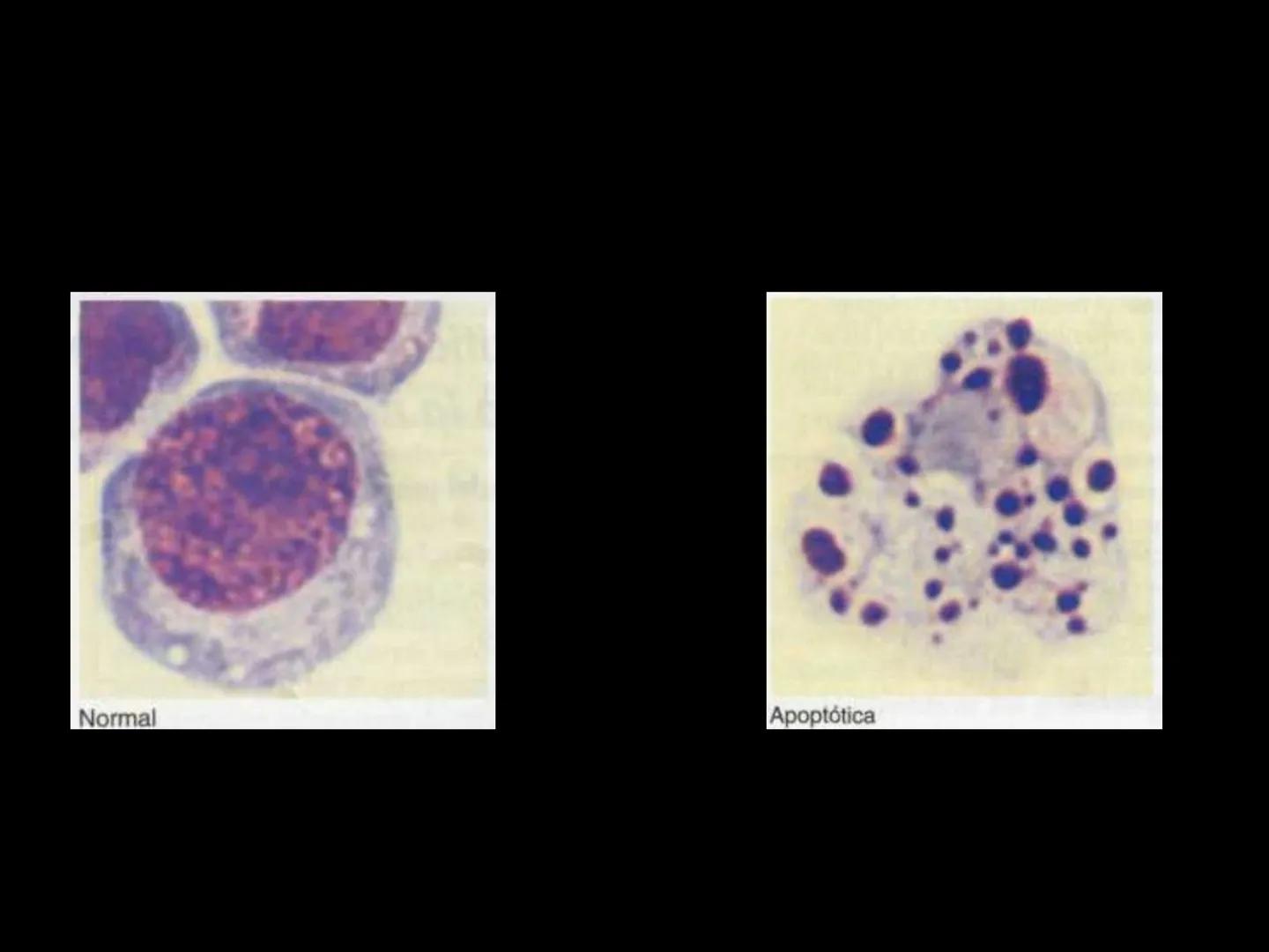 # INMUNOLOGÍA # Inmunidad
La palabra inmunidad significa protección contra la enfermedad y, más en concreto, contra una enfermedad infeccio