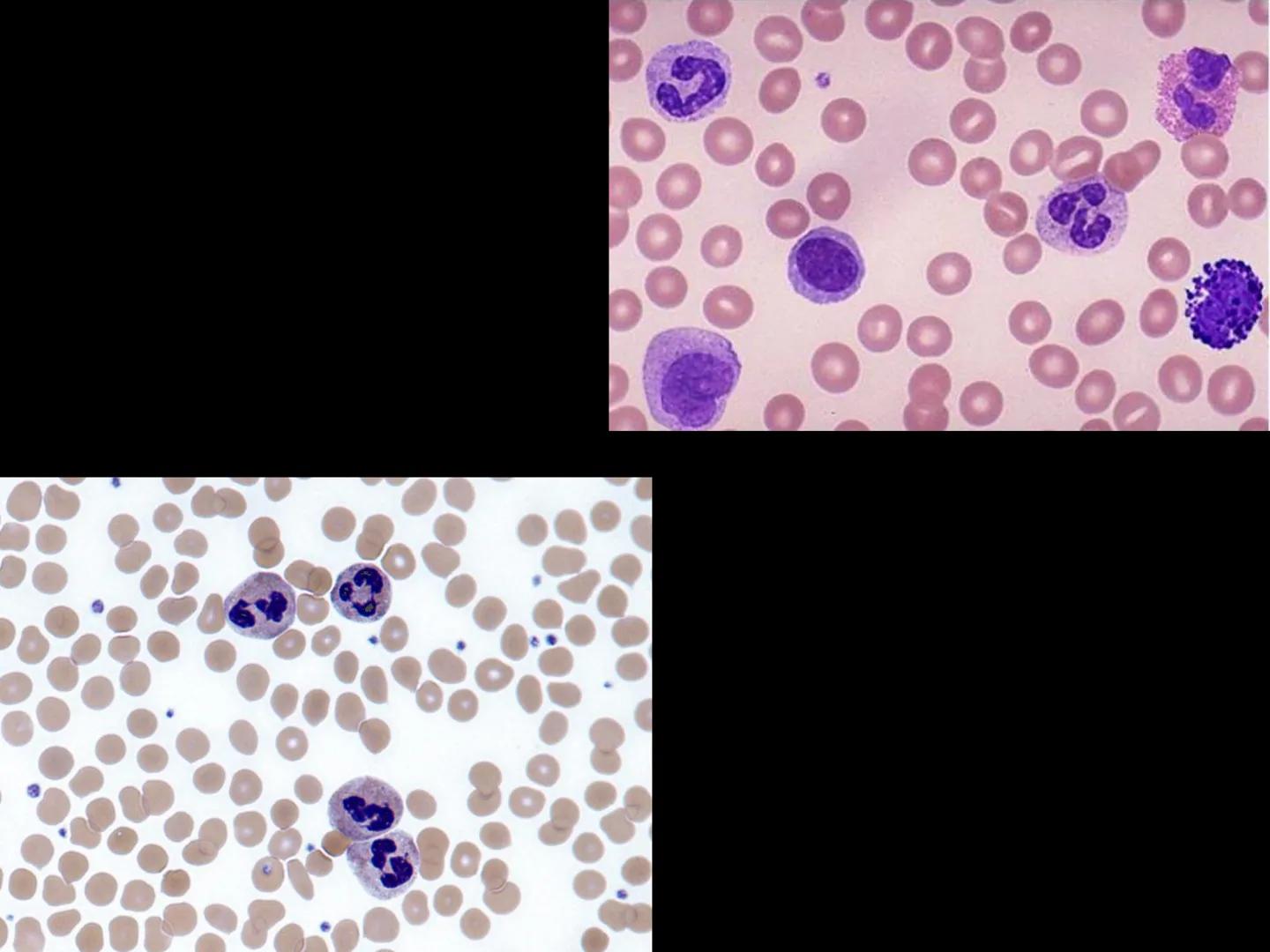 # INMUNOLOGÍA # Inmunidad
La palabra inmunidad significa protección contra la enfermedad y, más en concreto, contra una enfermedad infeccio