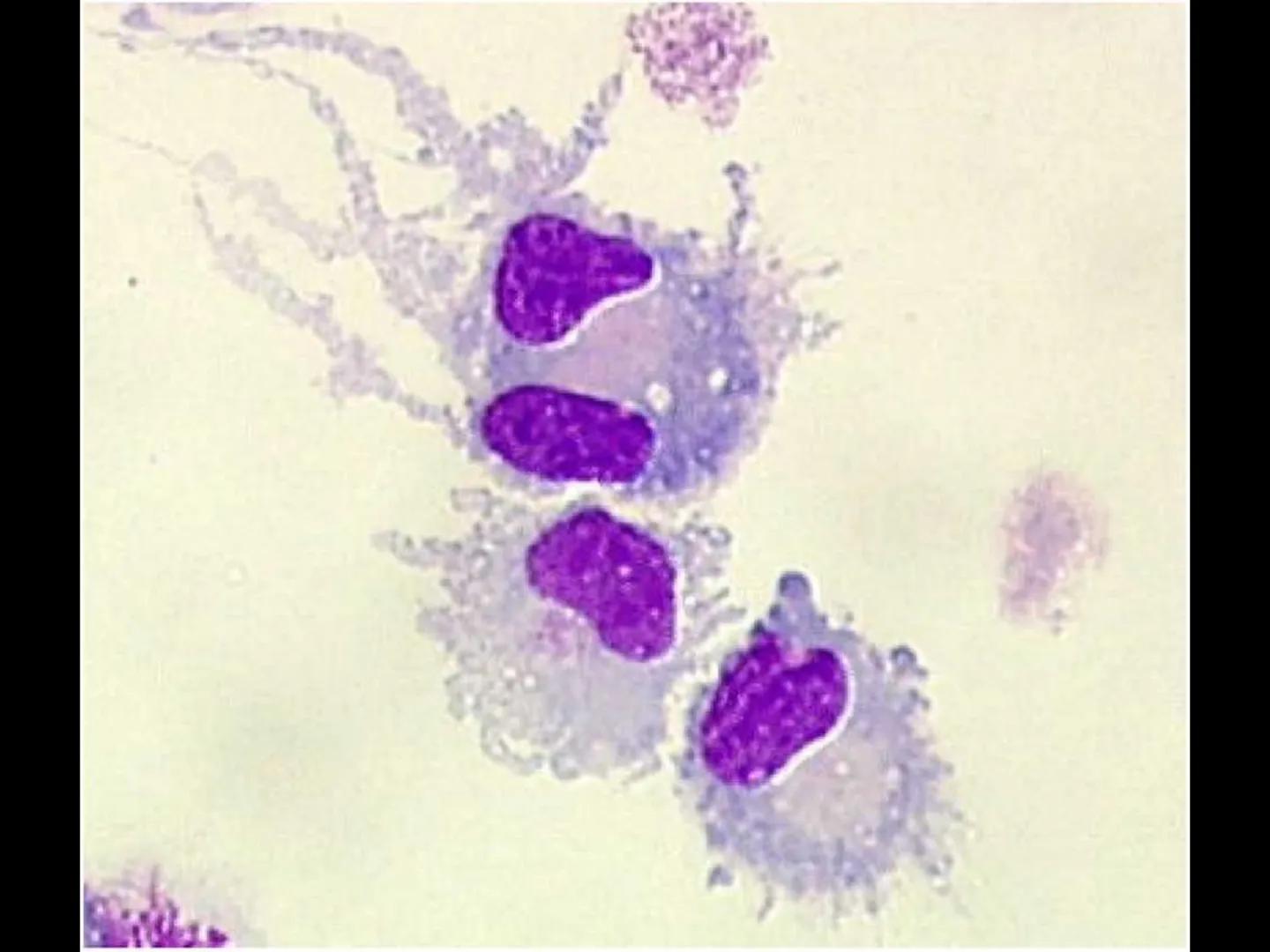 # INMUNOLOGÍA # Inmunidad
La palabra inmunidad significa protección contra la enfermedad y, más en concreto, contra una enfermedad infeccio