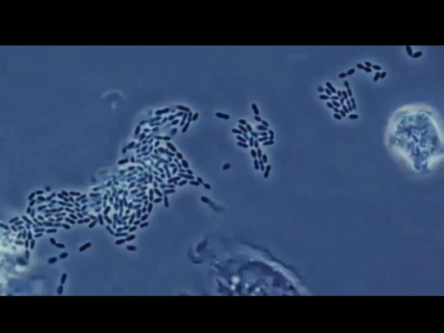 # INMUNOLOGÍA # Inmunidad
La palabra inmunidad significa protección contra la enfermedad y, más en concreto, contra una enfermedad infeccio