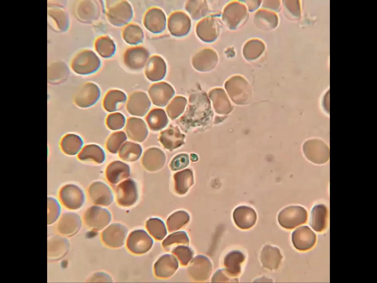 # INMUNOLOGÍA # Inmunidad
La palabra inmunidad significa protección contra la enfermedad y, más en concreto, contra una enfermedad infeccio