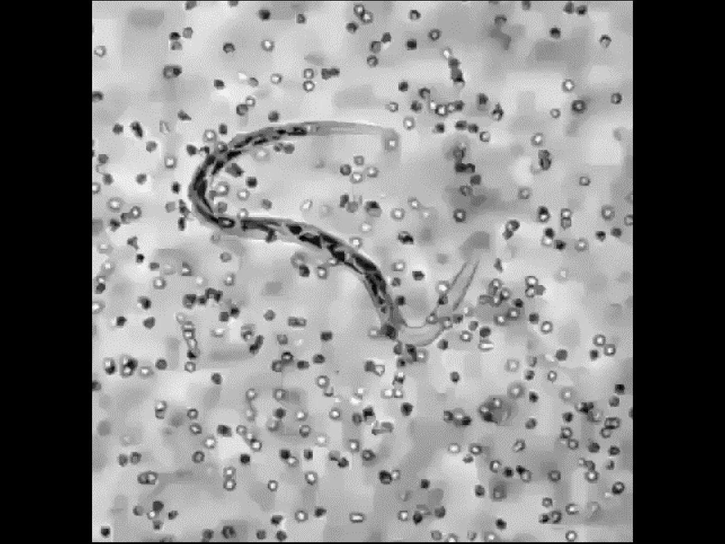 # INMUNOLOGÍA # Inmunidad
La palabra inmunidad significa protección contra la enfermedad y, más en concreto, contra una enfermedad infeccio