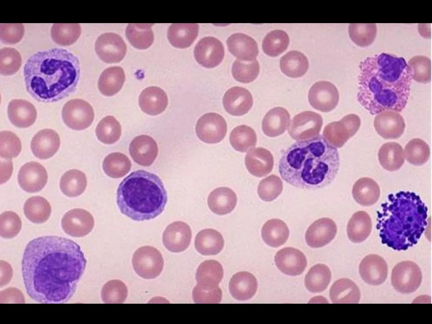 # INMUNOLOGÍA # Inmunidad
La palabra inmunidad significa protección contra la enfermedad y, más en concreto, contra una enfermedad infeccio
