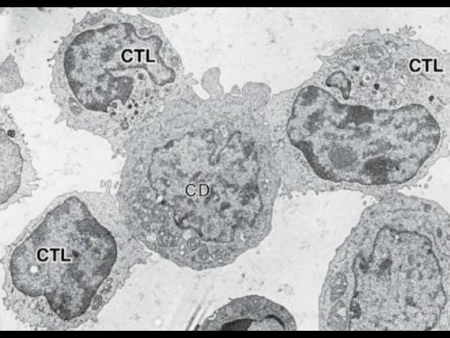 # INMUNOLOGÍA # Inmunidad
La palabra inmunidad significa protección contra la enfermedad y, más en concreto, contra una enfermedad infeccio