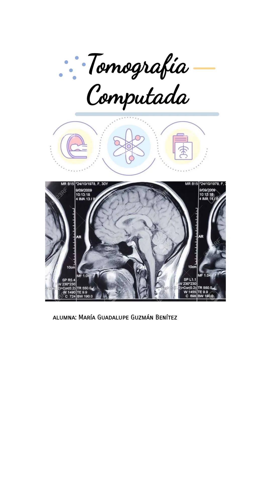 Tomografía
Computada
23RF
MR B15 *24/10/1978, F, 30Y
9/09/2009
10:13:18
4 IMA 13/8
MR B15 *24/10/1978, F. 2
9/09/2009
10:13:18
4 IMA 14/8
SP