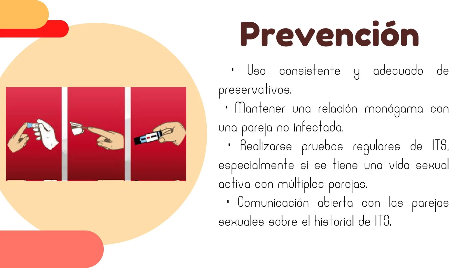 ## Gonorrea ¿Qué es?
La gonorrea es una infección de
transmisión sexual (ITS) causada por la
bacteria Neisseria gonorrhoeae. Es
importante c