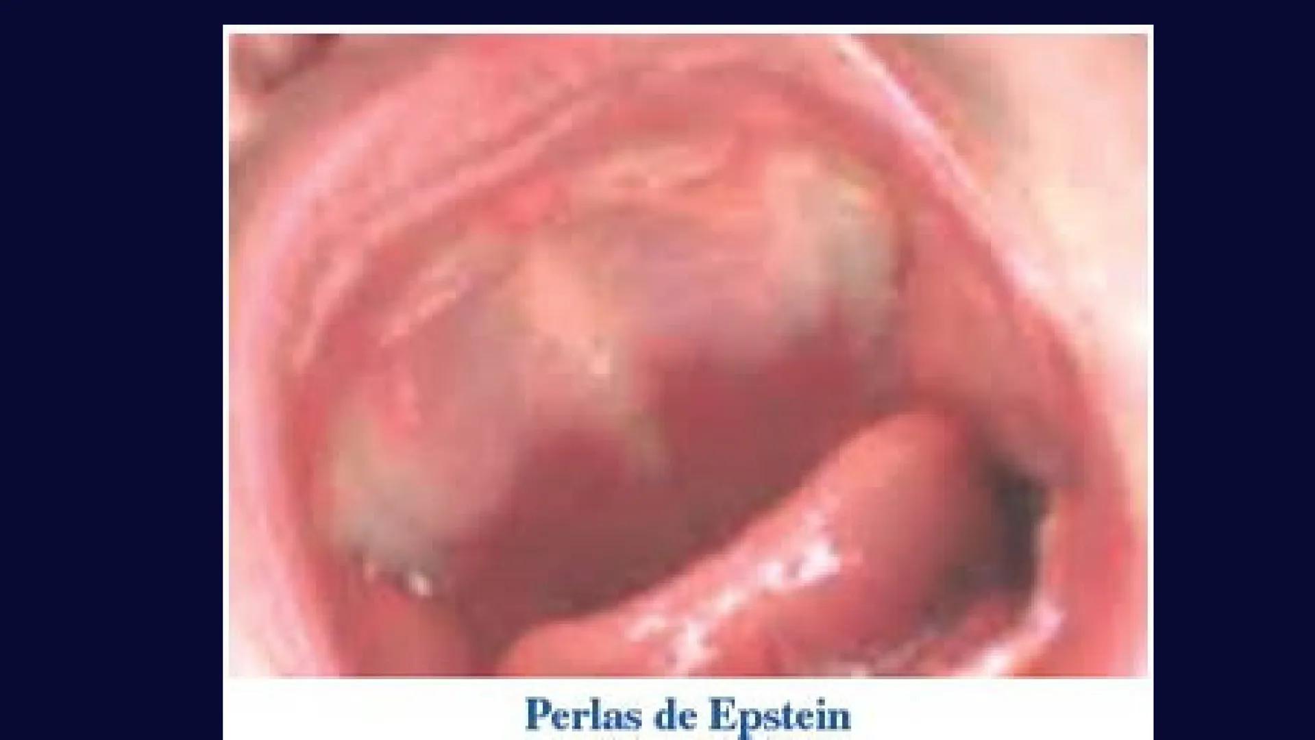 # Desarrollo de la cara y
sus patologías
Jaidy Michel Baeza Correa MAYO FOUNDATION FOR MEDICAL EDUCATION AND RESEARCH. ALL RIGHTS RESERVED