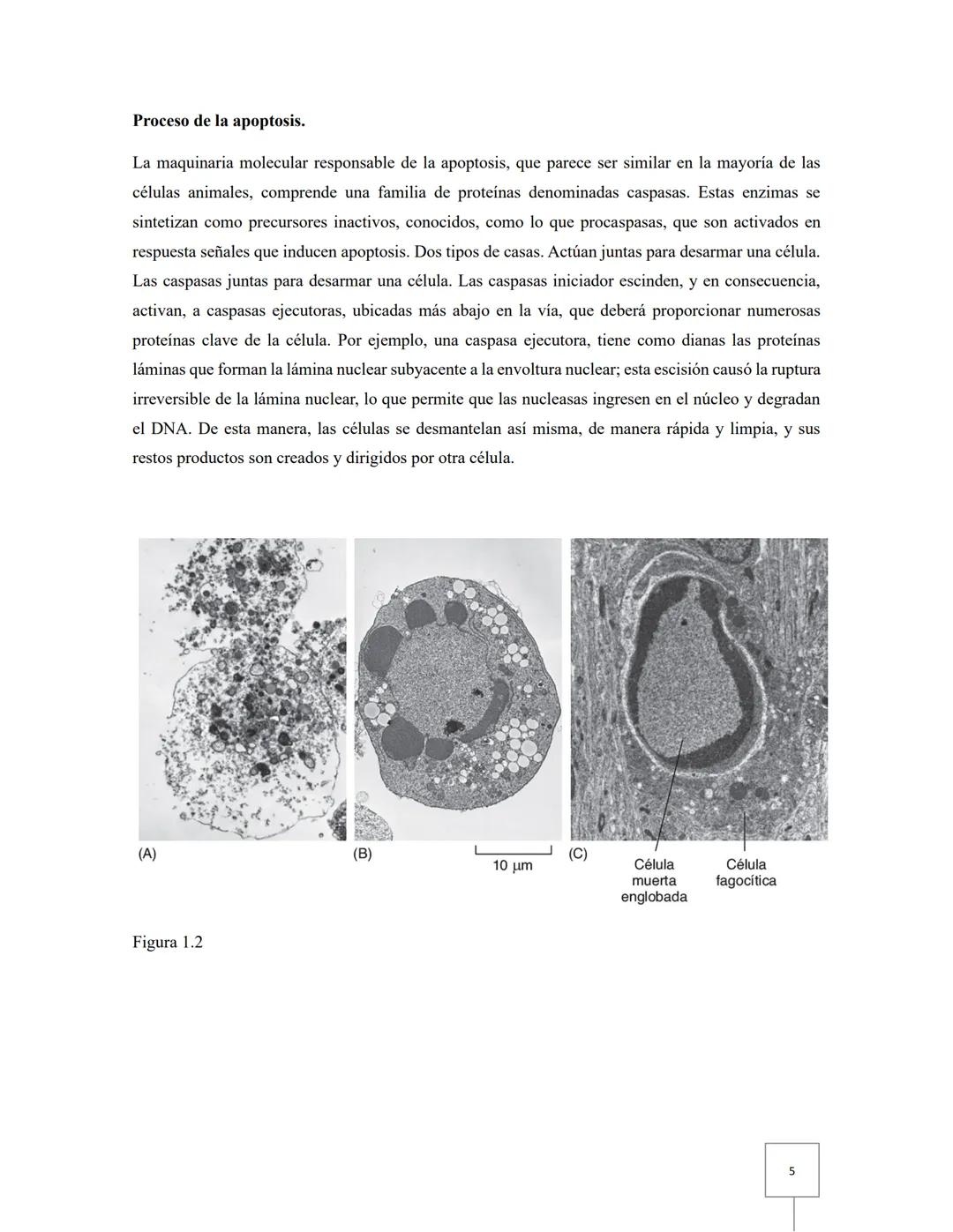 # Biología celular
# Taller 12: Apoptosis
Aguilar Fuerte Mia Alexandra
Ibarra Aburto Ricardo
Mercado Ramirez Viridiana
Garcia Cervantes
