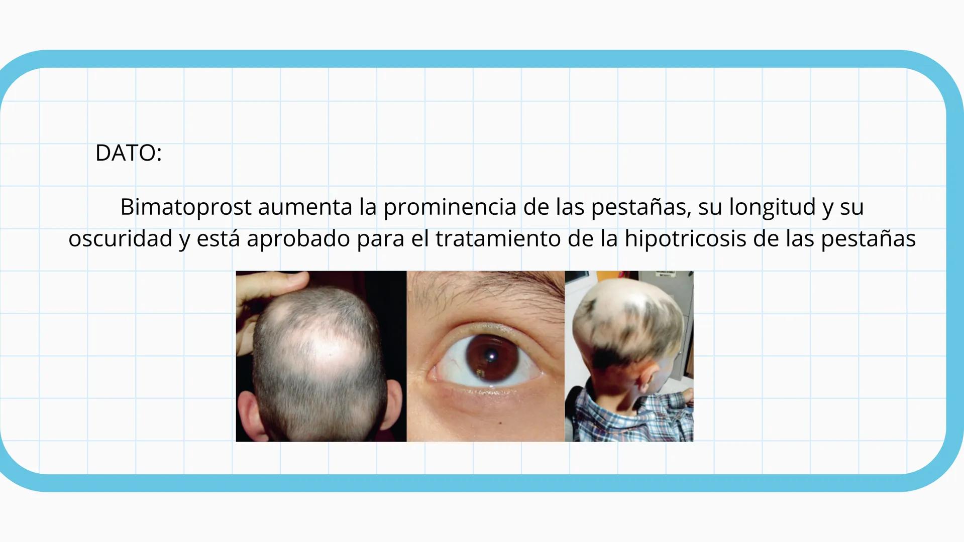 +
+
FARMACOLOGIA
ANTIINFLAMATORIOS, ANTIPÉRITICOS Y
ANALGESICOS
DIAZ JIMENEZ XTARENCA ESMERALDA
no puelo toy
inflamado
+
+ ¿QUÉ ES LA IN