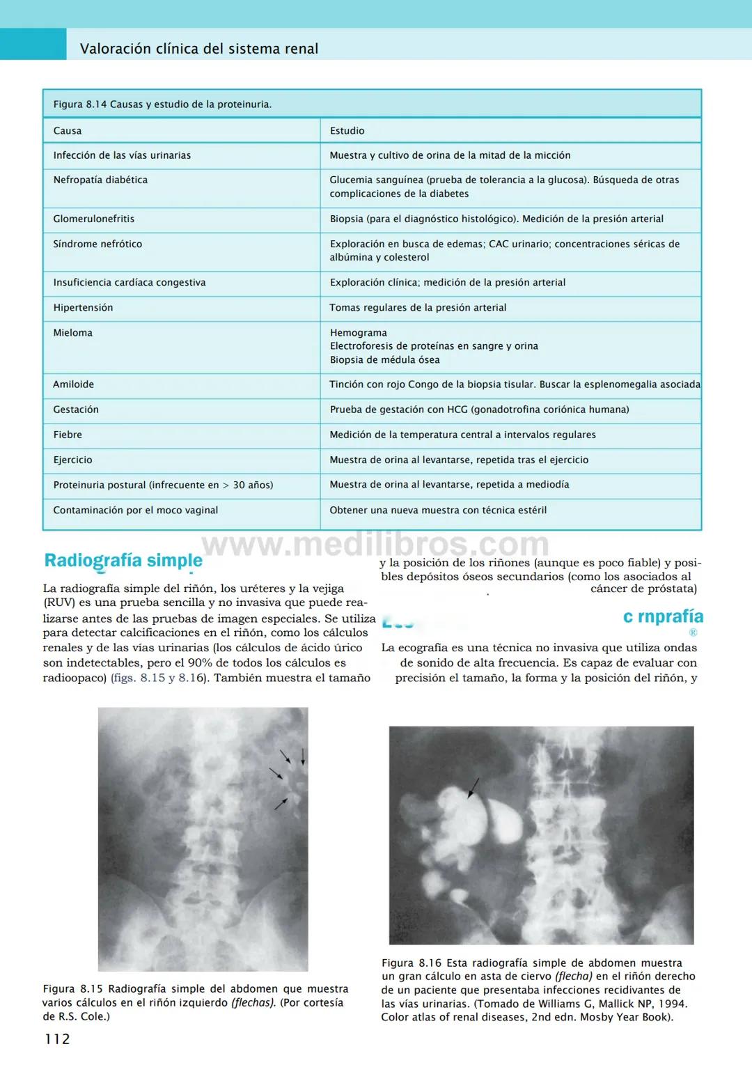 CIENCIAS BÁSICAS
4ª edición
CURSOS CRASH
Editor de la colección Dan Horton-Szar
Asesor académico: Kevin Harris
Lo esencial en
Sistema renal