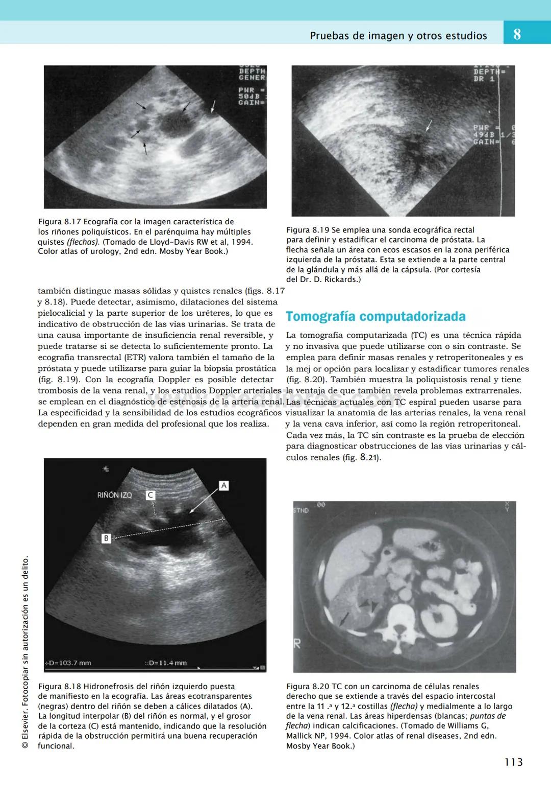 CIENCIAS BÁSICAS
4ª edición
CURSOS CRASH
Editor de la colección Dan Horton-Szar
Asesor académico: Kevin Harris
Lo esencial en
Sistema renal