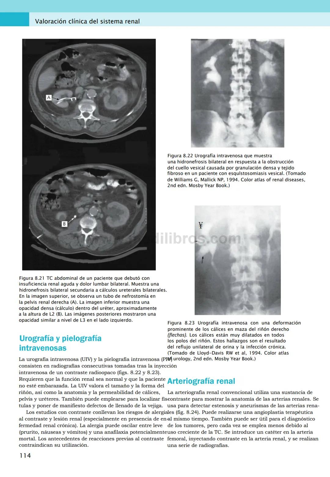 CIENCIAS BÁSICAS
4ª edición
CURSOS CRASH
Editor de la colección Dan Horton-Szar
Asesor académico: Kevin Harris
Lo esencial en
Sistema renal