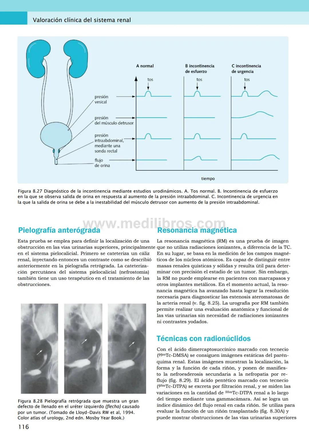CIENCIAS BÁSICAS
4ª edición
CURSOS CRASH
Editor de la colección Dan Horton-Szar
Asesor académico: Kevin Harris
Lo esencial en
Sistema renal