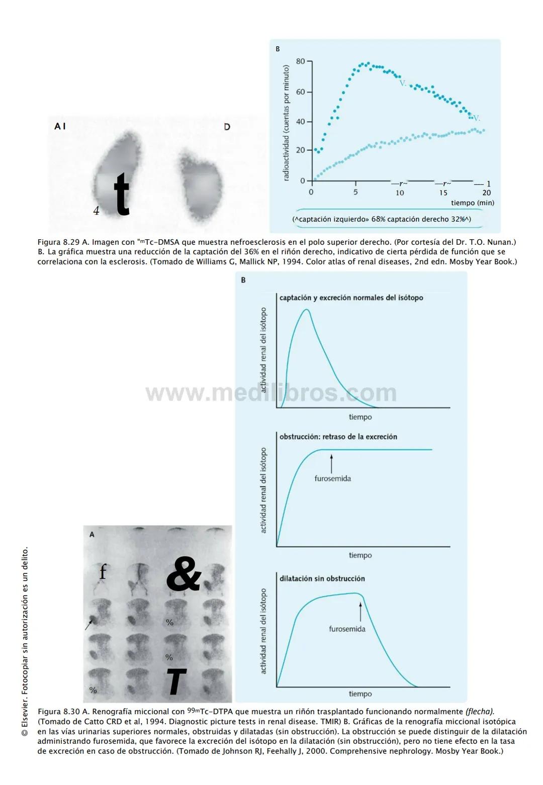 CIENCIAS BÁSICAS
4ª edición
CURSOS CRASH
Editor de la colección Dan Horton-Szar
Asesor académico: Kevin Harris
Lo esencial en
Sistema renal