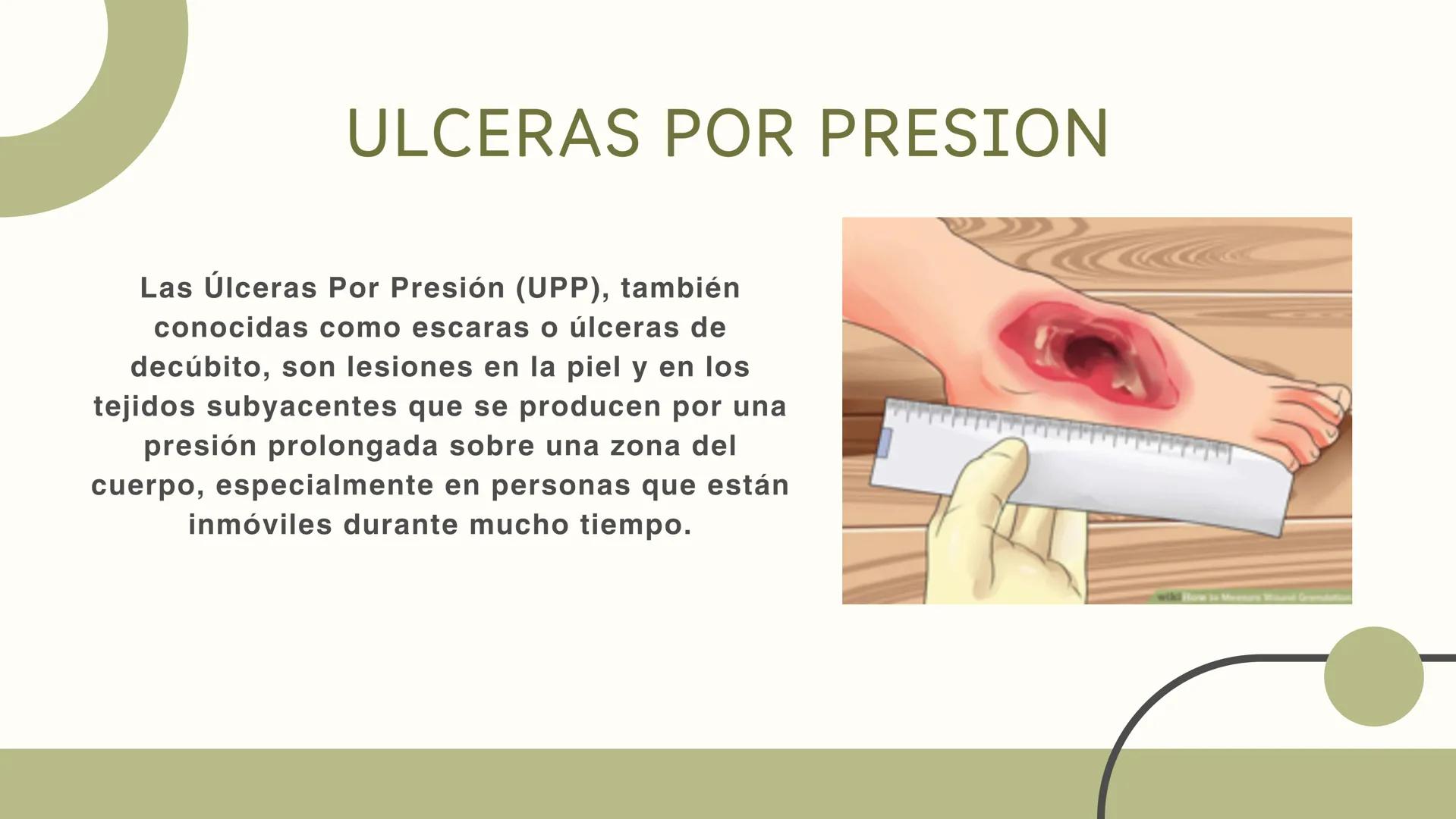 # ULCERAS POR
PRESION, CAIDAS Y
VERTIGO
EQUIPO 5 ULCERAS POR PRESION
Las Úlceras Por Presión (UPP), también
conocidas como escaras o úlce