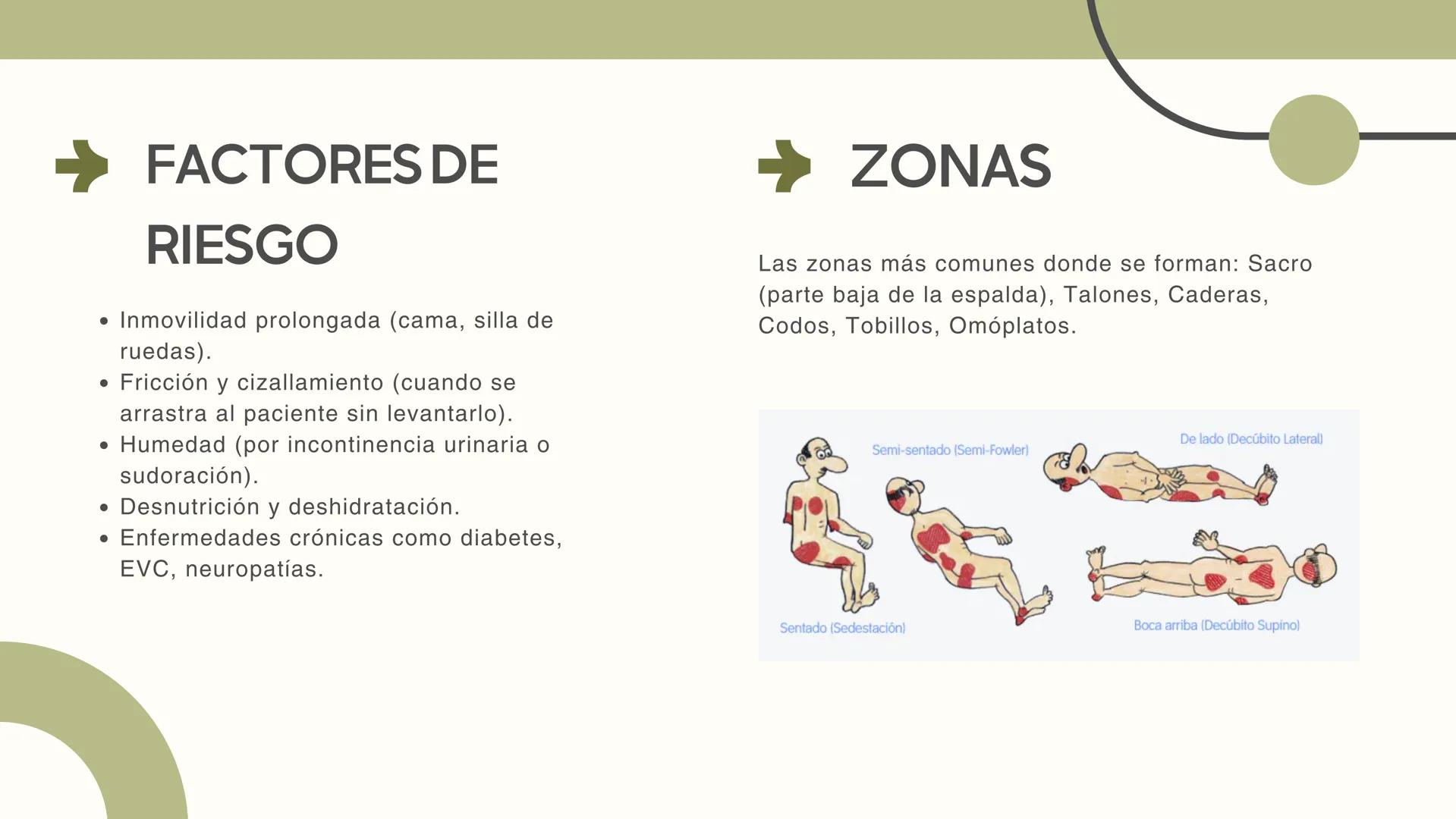 # ULCERAS POR
PRESION, CAIDAS Y
VERTIGO
EQUIPO 5 ULCERAS POR PRESION
Las Úlceras Por Presión (UPP), también
conocidas como escaras o úlce