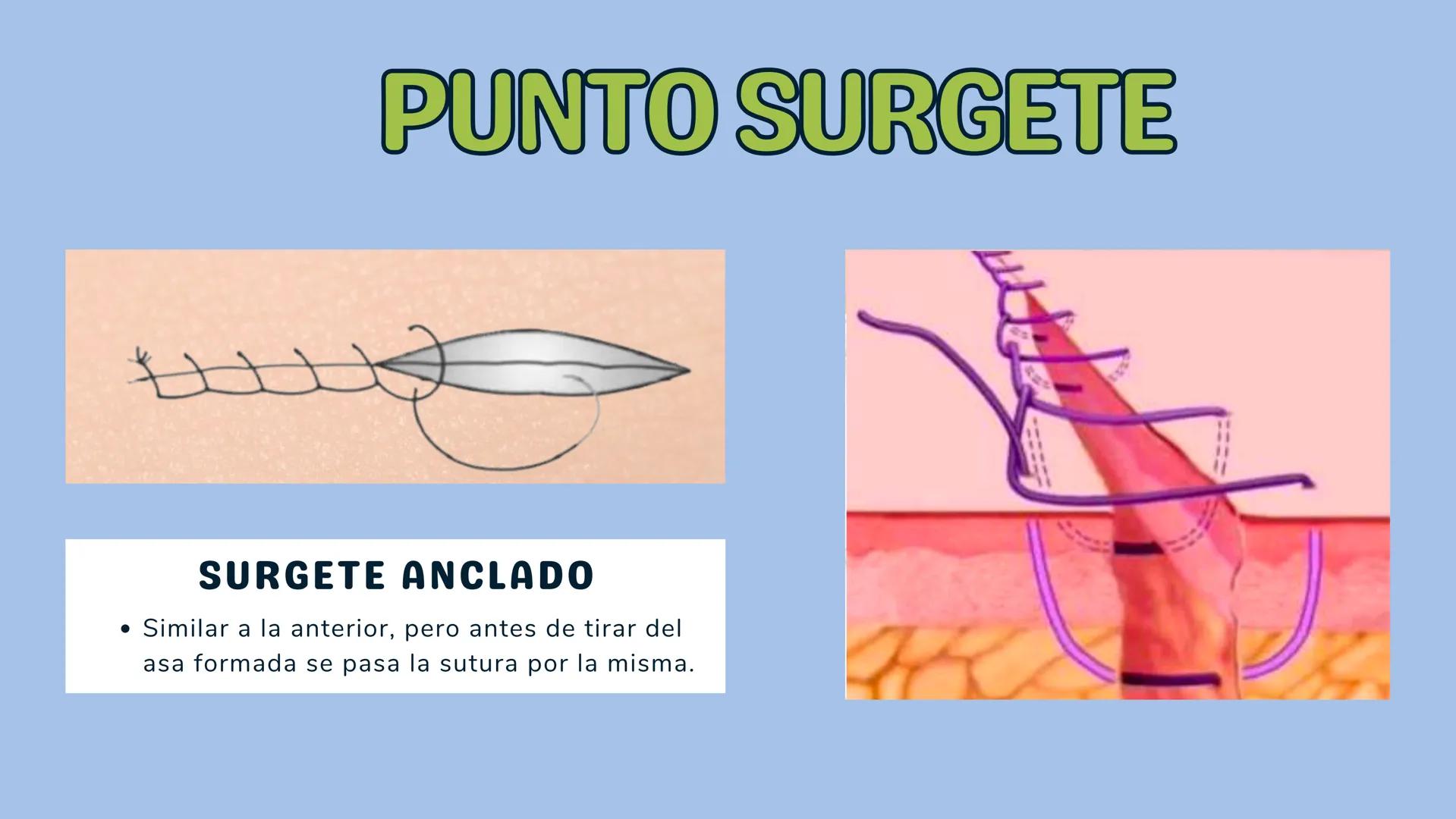 # TÉCNICAS QUIRÚRGICAS
# PUNTOS DE SUTURA
MARÍA FERNANDA LANDEROS RODRÍGUEZ # NORMA OFICIAL MEXICANA
# NOM-067-SSA1-1993
ESTABLECE LAS ES