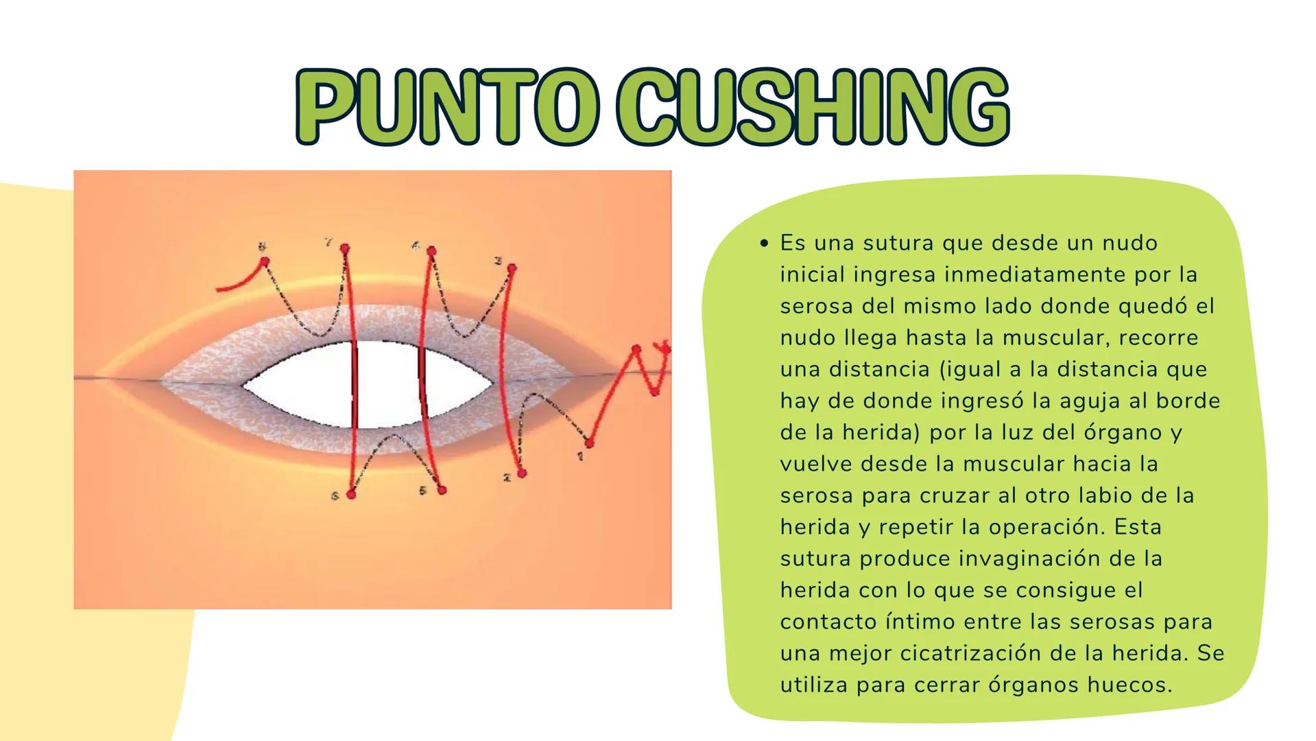 # TÉCNICAS QUIRÚRGICAS
# PUNTOS DE SUTURA
MARÍA FERNANDA LANDEROS RODRÍGUEZ # NORMA OFICIAL MEXICANA
# NOM-067-SSA1-1993
ESTABLECE LAS ES