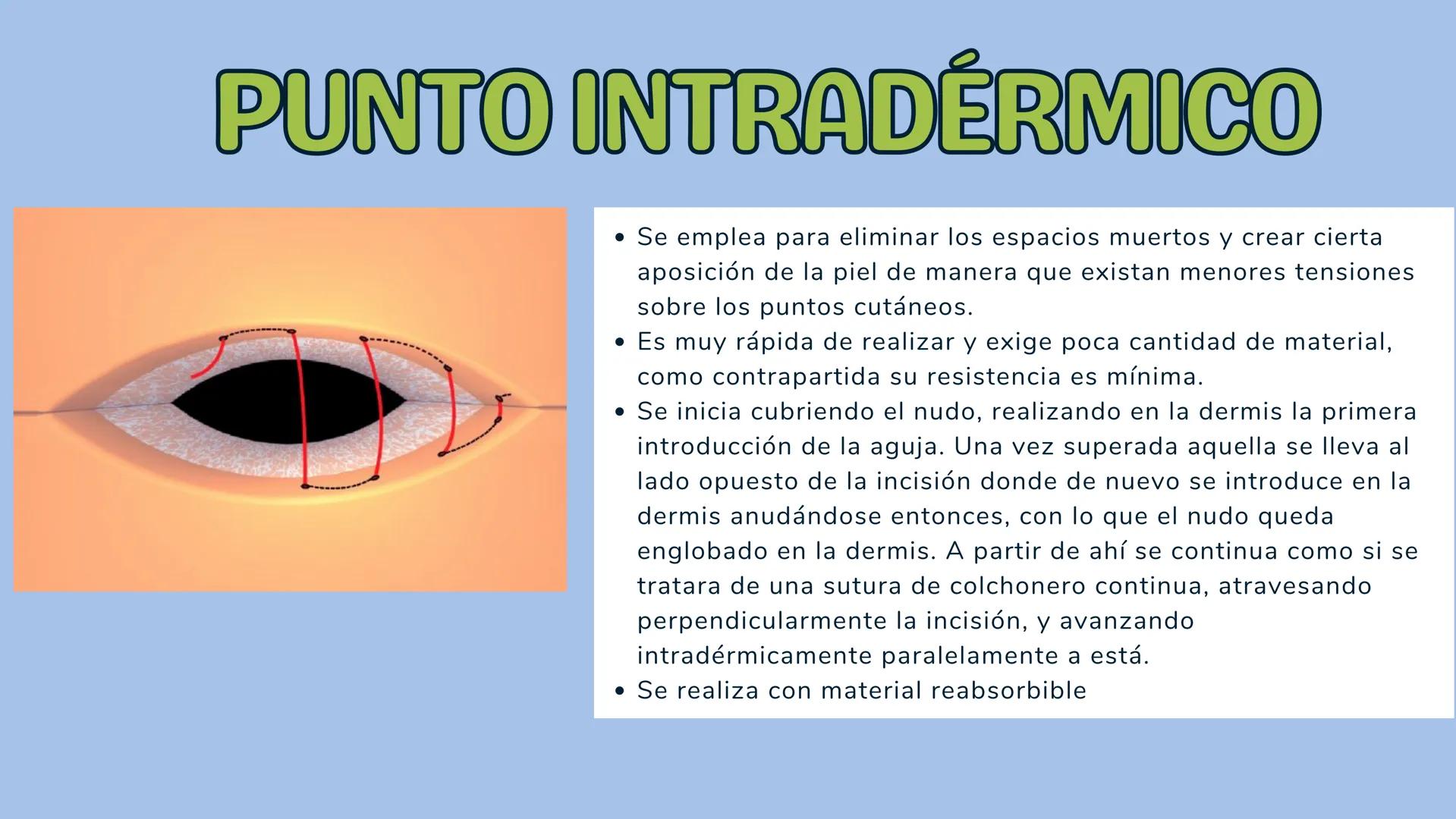 # TÉCNICAS QUIRÚRGICAS
# PUNTOS DE SUTURA
MARÍA FERNANDA LANDEROS RODRÍGUEZ # NORMA OFICIAL MEXICANA
# NOM-067-SSA1-1993
ESTABLECE LAS ES