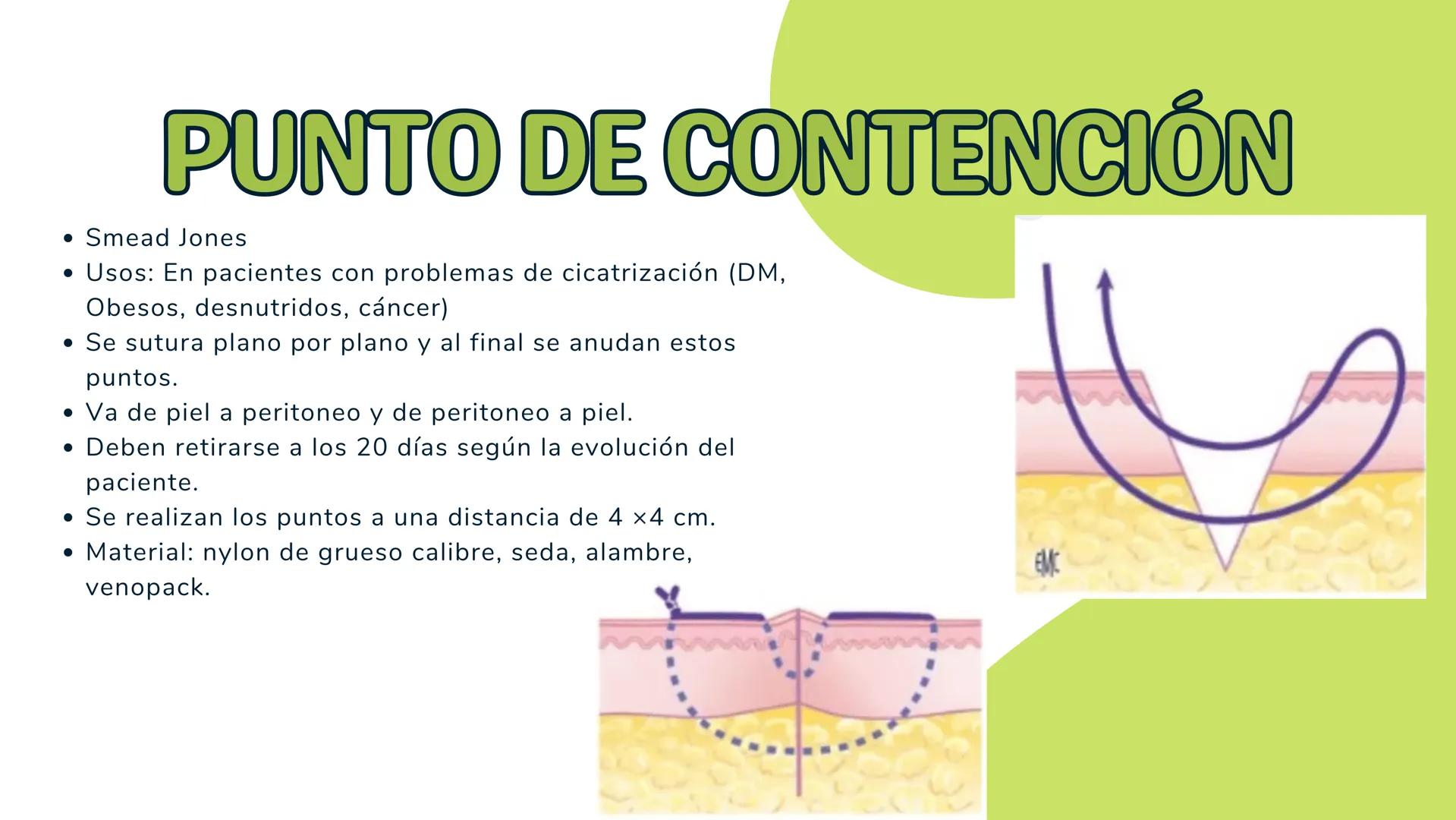 # TÉCNICAS QUIRÚRGICAS
# PUNTOS DE SUTURA
MARÍA FERNANDA LANDEROS RODRÍGUEZ # NORMA OFICIAL MEXICANA
# NOM-067-SSA1-1993
ESTABLECE LAS ES