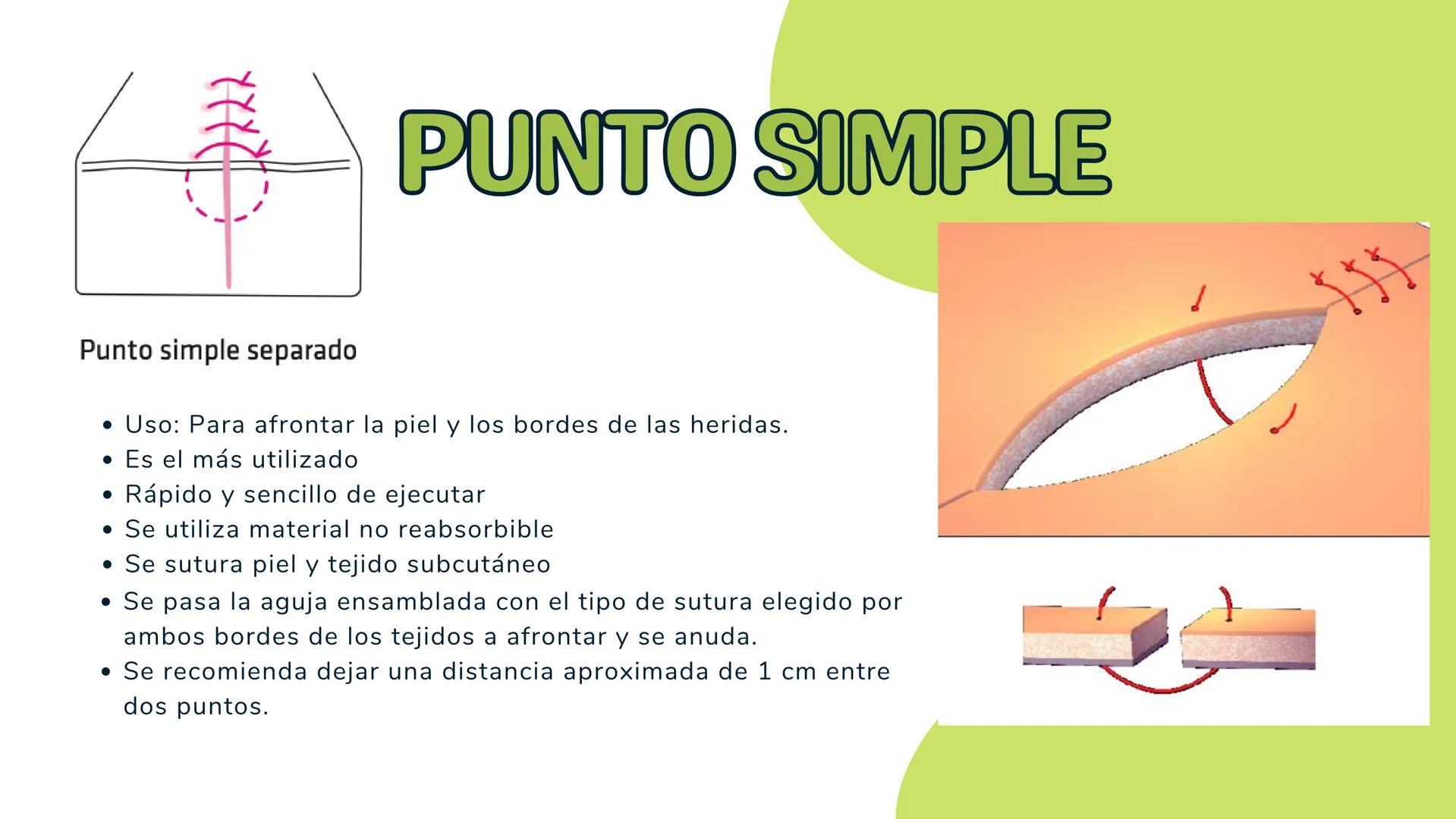 # TÉCNICAS QUIRÚRGICAS
# PUNTOS DE SUTURA
MARÍA FERNANDA LANDEROS RODRÍGUEZ # NORMA OFICIAL MEXICANA
# NOM-067-SSA1-1993
ESTABLECE LAS ES