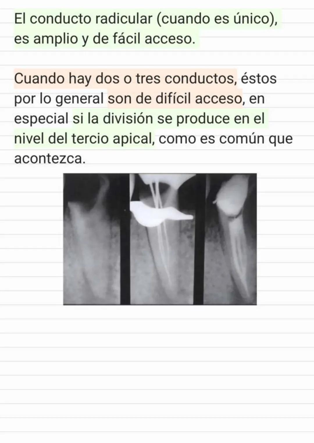 Tema.1 Endodoncia
¿Qué es la Endodoncia?
Es el estudio de la
estructura, la morfología, la
fisiología y la patología de la
pulpa dental y de