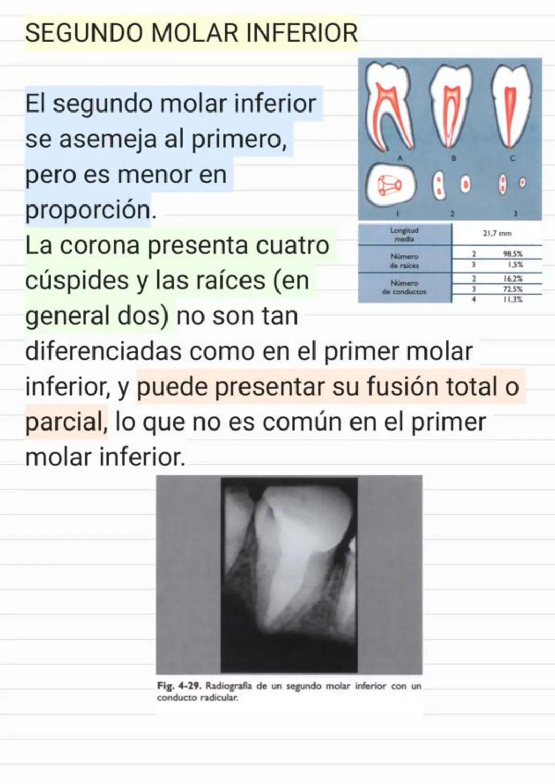 Tema.1 Endodoncia
¿Qué es la Endodoncia?
Es el estudio de la
estructura, la morfología, la
fisiología y la patología de la
pulpa dental y de