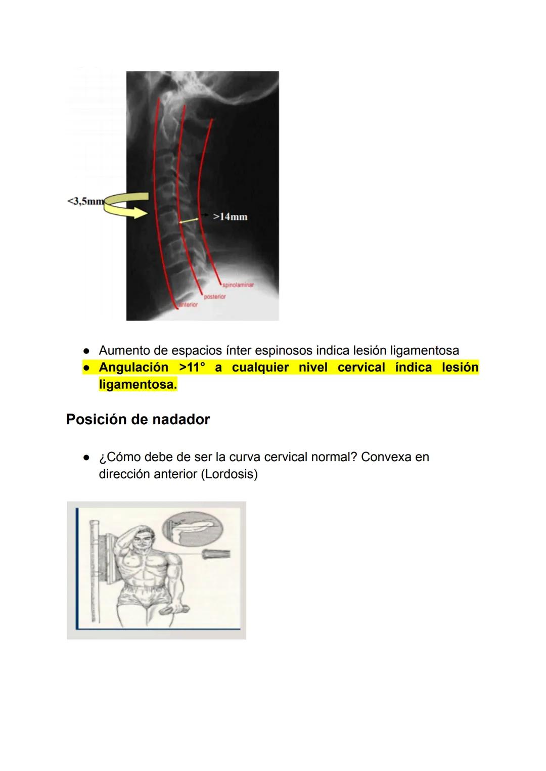 Tema 2: COLUMNA VERTEBRAL
2.1 -Radiografía de columna vertebral
Dolor en la espalda:
Congénitas/desarrollo:
• Meningocele
• Mielomeningocele