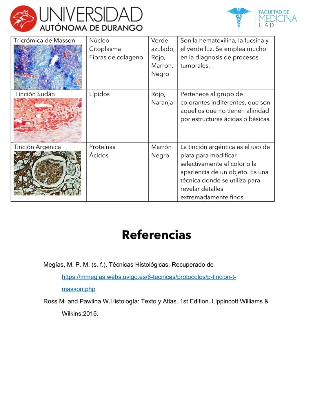 --- OCR Start ---
UNIVERSIDAD
AUTÓNOMA DE DURANGO
Nombre de la tinción
Hematoxilina-eosina
Tinciones Histológicas
Color
Tejido que tiñe
Núcl