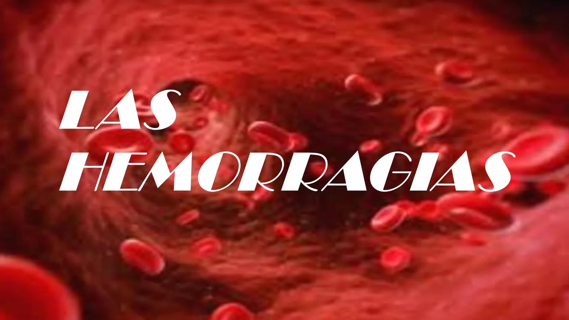 # LAS HEMORRAGIAS ¿QUE ES UNA HEMORRAGIA?
La hemorragia es la salida de sangre de los vasos
sanguíneos de manera anormal. Puede ocurrir
tant