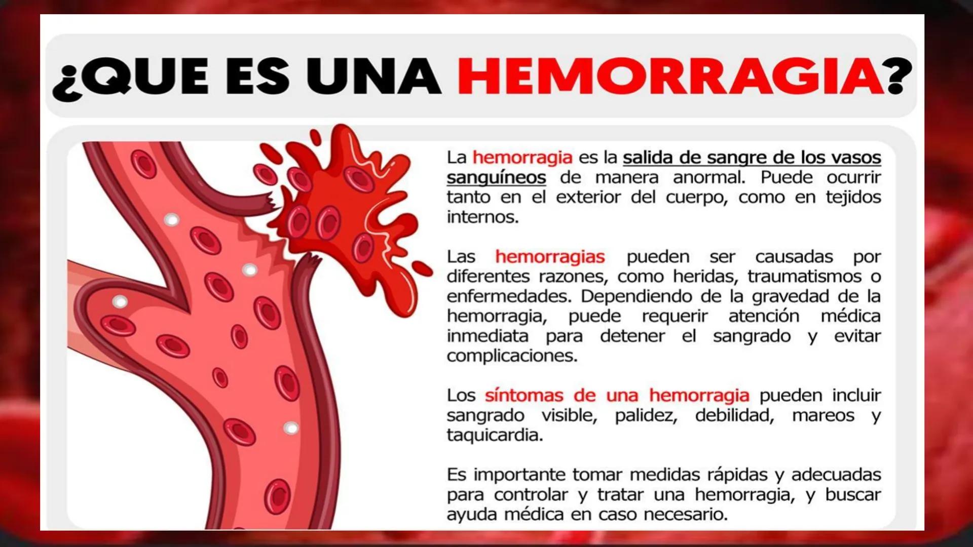 # LAS HEMORRAGIAS ¿QUE ES UNA HEMORRAGIA?
La hemorragia es la salida de sangre de los vasos
sanguíneos de manera anormal. Puede ocurrir
tant