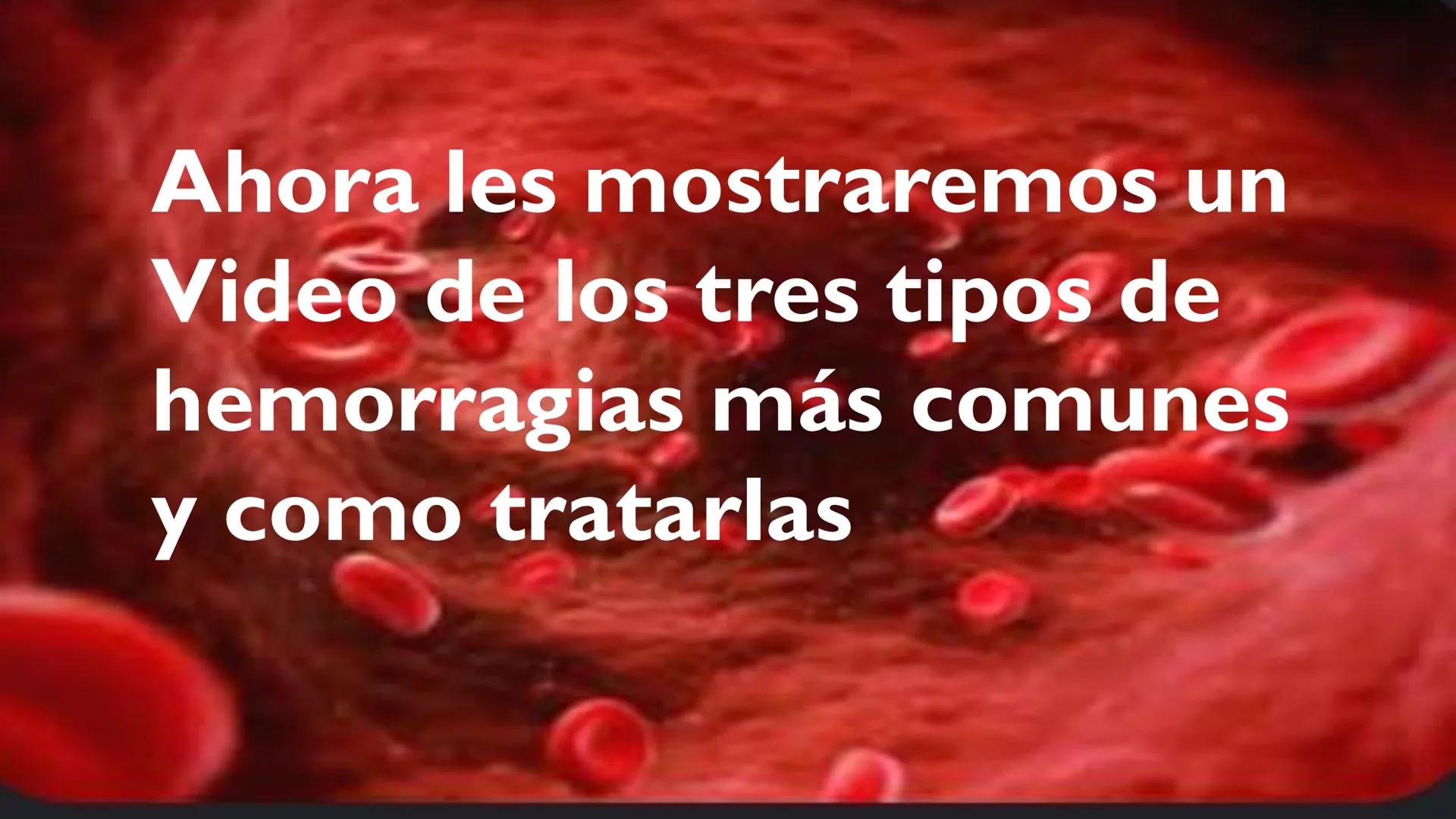 # LAS HEMORRAGIAS ¿QUE ES UNA HEMORRAGIA?
La hemorragia es la salida de sangre de los vasos
sanguíneos de manera anormal. Puede ocurrir
tant