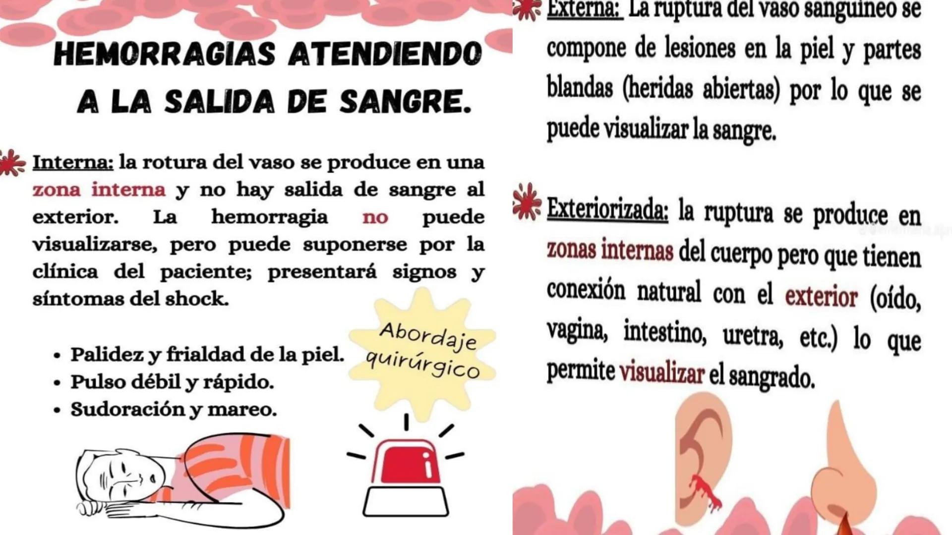 # LAS HEMORRAGIAS ¿QUE ES UNA HEMORRAGIA?
La hemorragia es la salida de sangre de los vasos
sanguíneos de manera anormal. Puede ocurrir
tant
