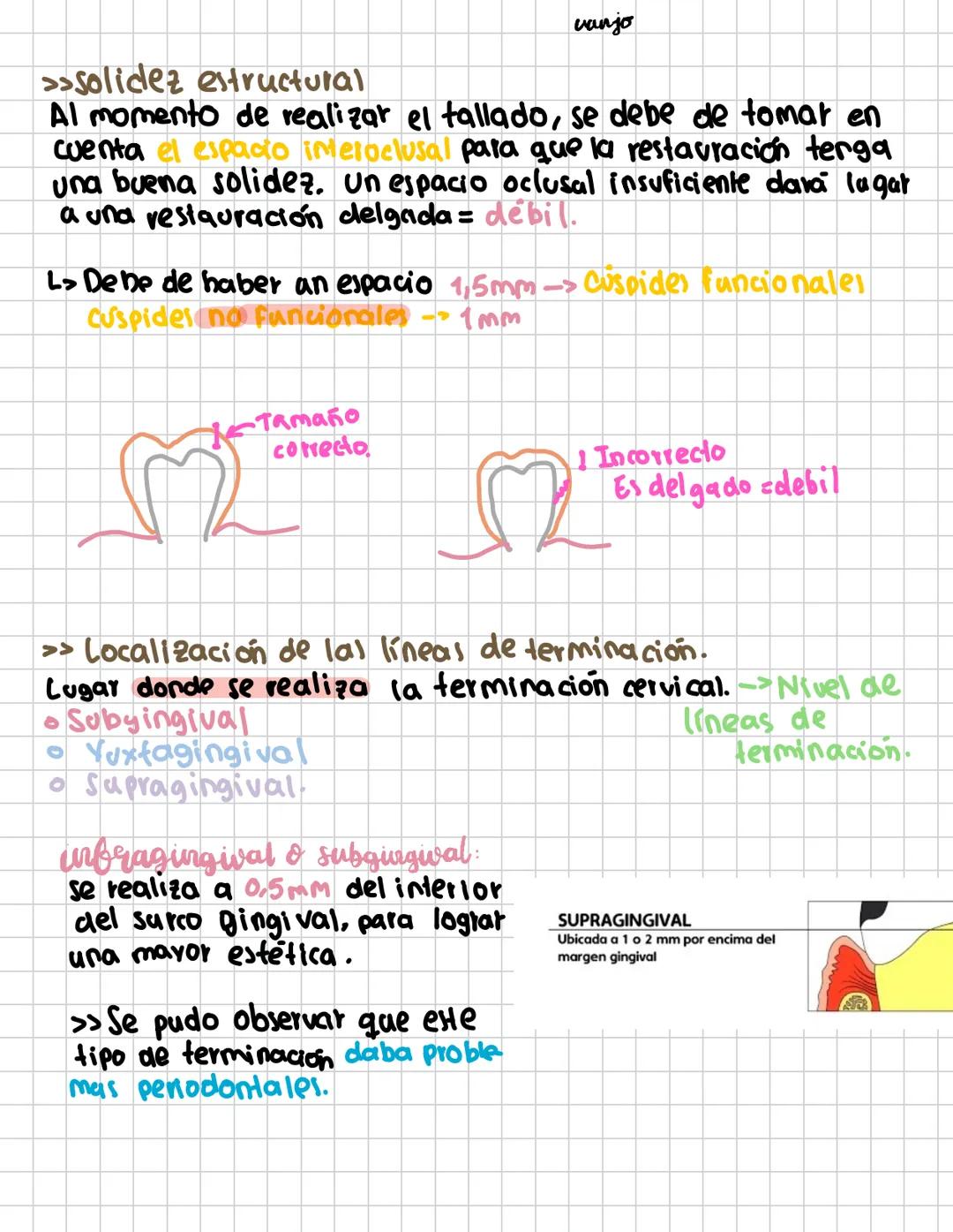 COMPOSITION BOOK
protesis dental
Biza
by: narajo # protesis bija
Es un aparato protésico permanente
unido o cementado a los dientes
remanen