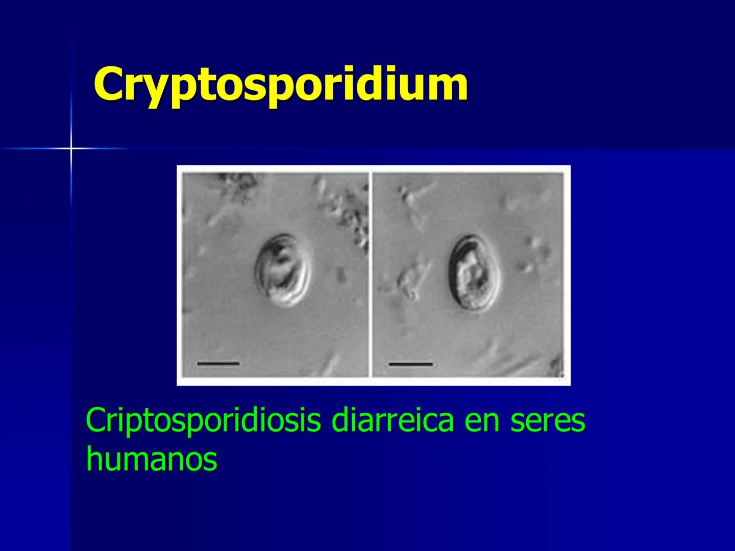 # Protozoarios
100 μm # Protozoarios
■ Son unicelulares pertenecientes al Reino Protista,
subreino Protozoa.
* Eucariotas, microscopico