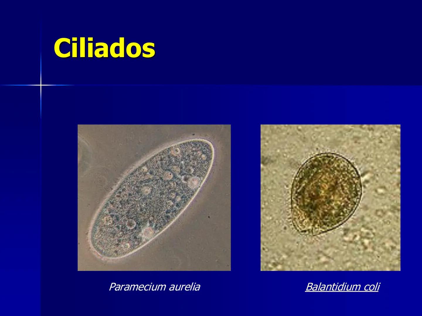 # Protozoarios
100 μm # Protozoarios
■ Son unicelulares pertenecientes al Reino Protista,
subreino Protozoa.
* Eucariotas, microscopico